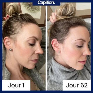 Roll-On Sérum Repousse