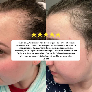 Roll-On Sérum Repousse