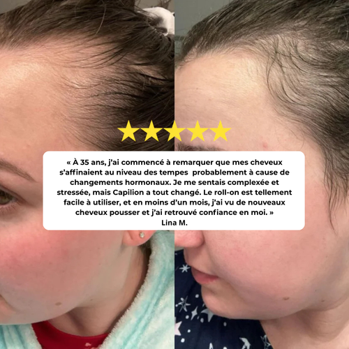 Roll-On Sérum Repousse